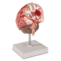 Large view Pathological Model of Brain 