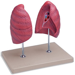 Left and Right Lungs Model