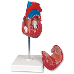 Heart Hypertrophy Model