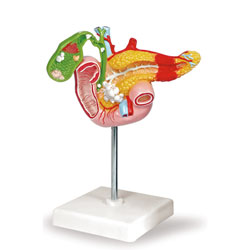 Gallbladder, Pancreas, and Duodenum Disease Model 